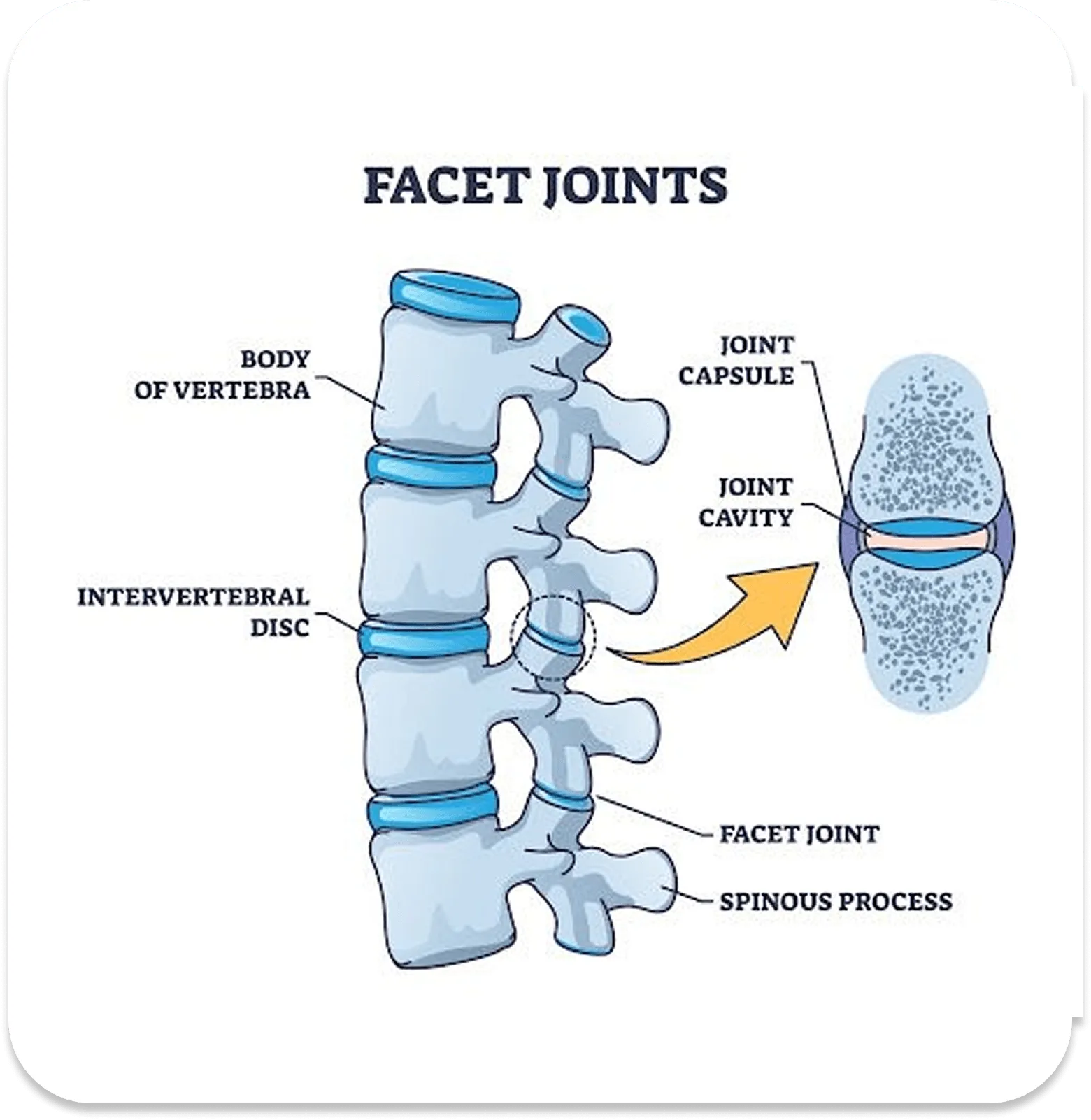Facet joints and disc degeneration anatomy